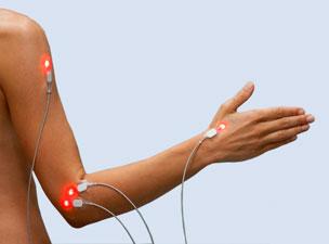 LightNeedle Laserakupunktur, Laserstimulation